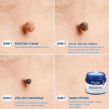 𝐏𝐢𝐜𝐝𝐨®🧑‍⚕️ 7-dnevna 𝐤𝐫𝐞𝐦𝐚 𝐳𝐚 𝐤𝐨ž𝐧𝐞 𝐢𝐳𝐫𝐚𝐬𝐭𝐚𝐣𝐞 & 𝐩𝐢𝐠𝐦𝐞𝐧𝐭𝐚𝐜𝐢𝐣𝐬𝐤𝐞 𝐦𝐫𝐥𝐣𝐞 (bezbolna formula – bez ožiljaka)🌾⑤