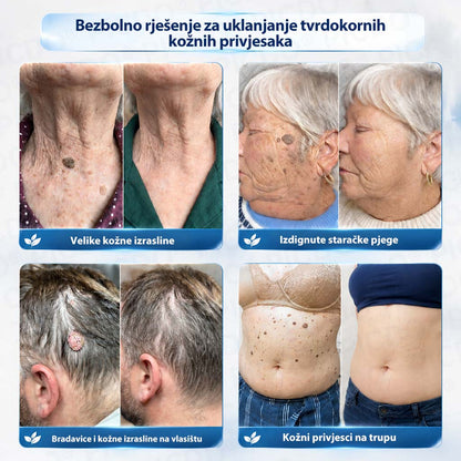 𝐏𝐢𝐜𝐝𝐨®🧑‍⚕️ 7-dnevna 𝐤𝐫𝐞𝐦𝐚 𝐳𝐚 𝐤𝐨ž𝐧𝐞 𝐢𝐳𝐫𝐚𝐬𝐭𝐚𝐣𝐞 & 𝐩𝐢𝐠𝐦𝐞𝐧𝐭𝐚𝐜𝐢𝐣𝐬𝐤𝐞 𝐦𝐫𝐥𝐣𝐞 (bezbolna formula – bez ožiljaka)🌾⑤