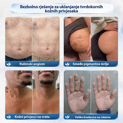 𝐏𝐢𝐜𝐝𝐨®🧑‍⚕️ 7-dnevna 𝐤𝐫𝐞𝐦𝐚 𝐳𝐚 𝐤𝐨ž𝐧𝐞 𝐢𝐳𝐫𝐚𝐬𝐭𝐚𝐣𝐞 & 𝐩𝐢𝐠𝐦𝐞𝐧𝐭𝐚𝐜𝐢𝐣𝐬𝐤𝐞 𝐦𝐫𝐥𝐣𝐞 (bezbolna formula – bez ožiljaka)🌾⑤