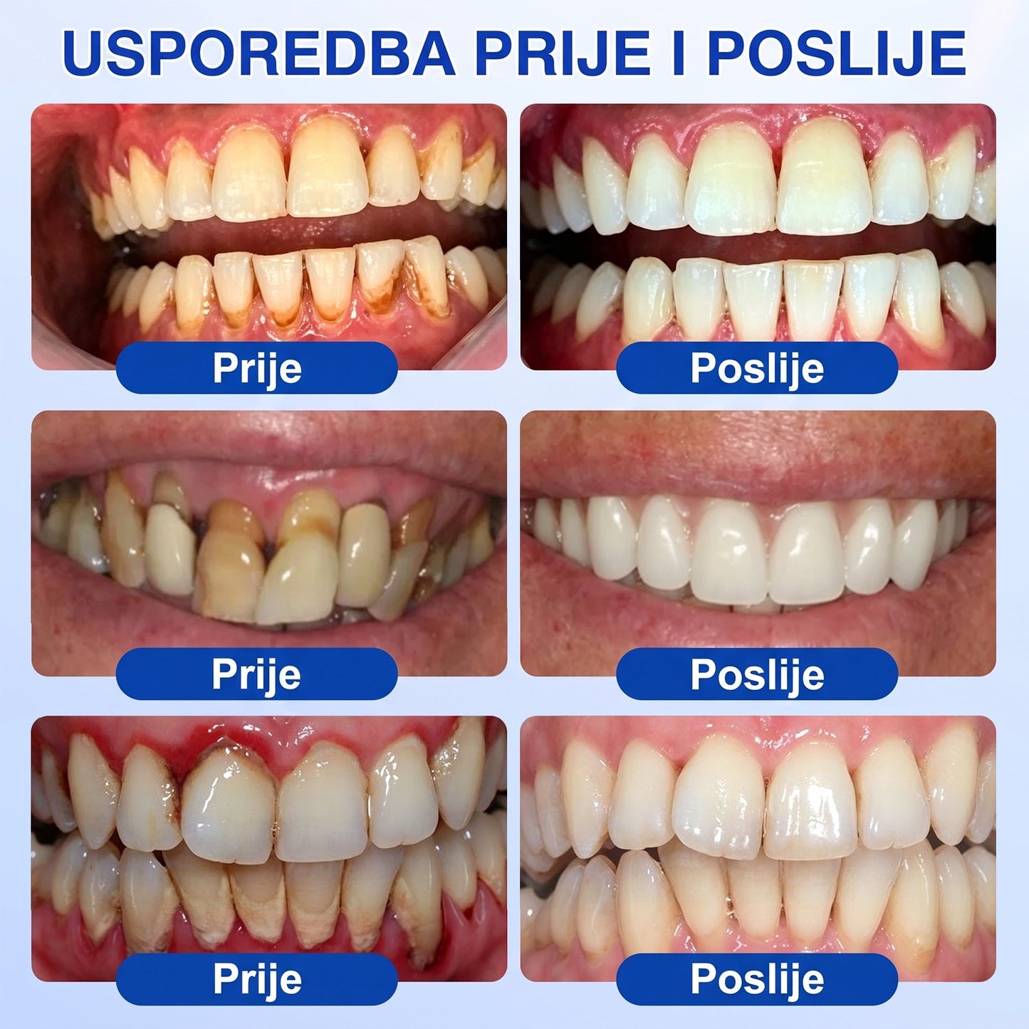Evolvion® 🦷GumRevive gel za obnovu parodonta🍒