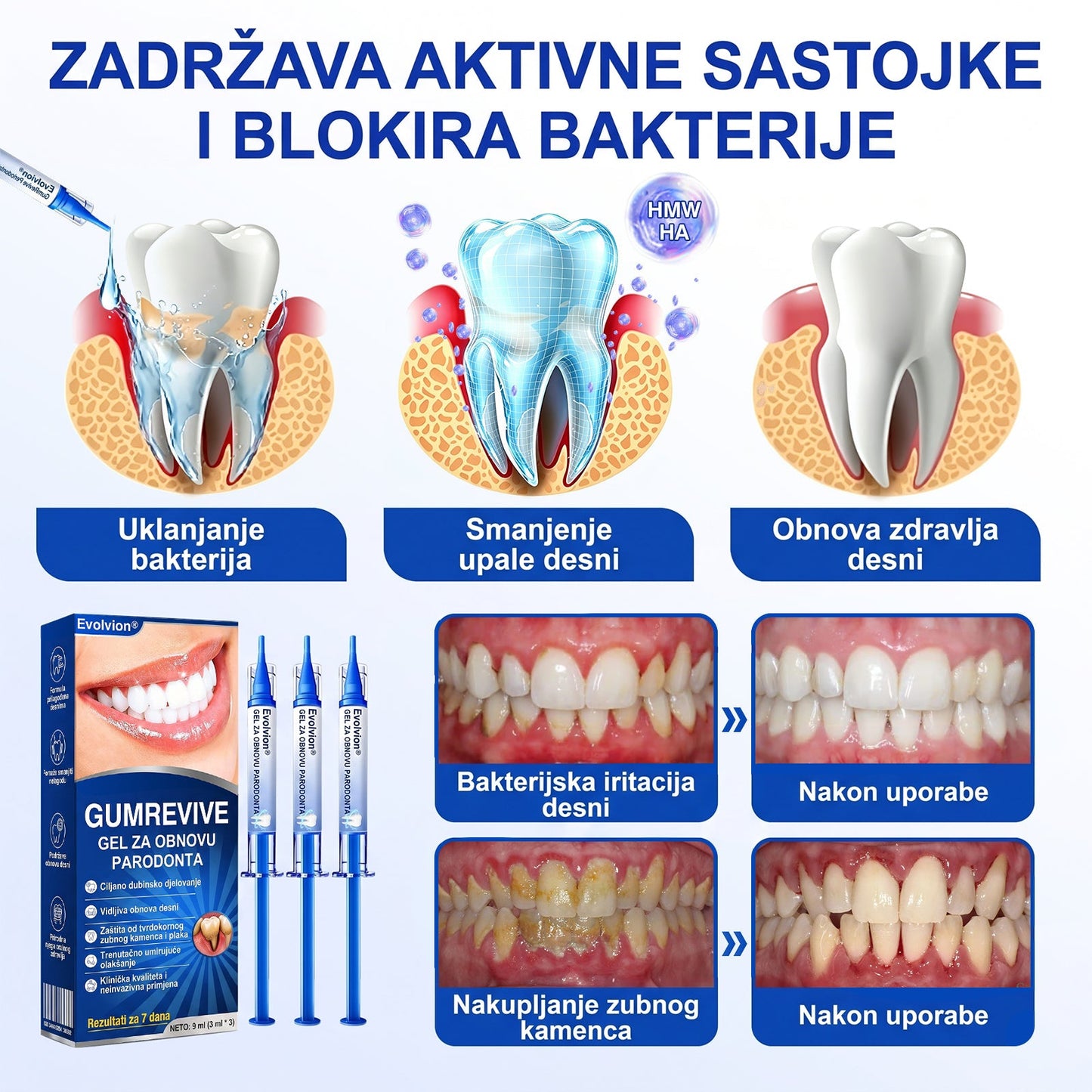 Evolvion® 🦷GumRevive gel za obnovu parodonta🍒