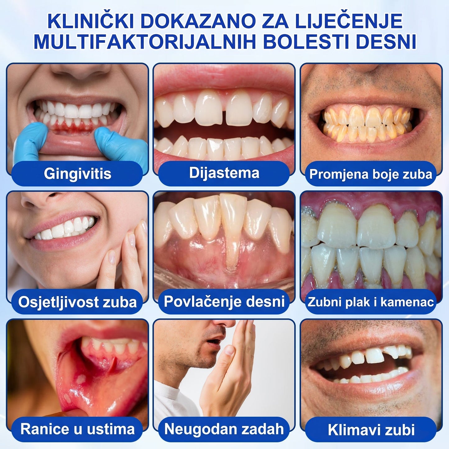 Evolvion® 🦷GumRevive gel za obnovu parodonta🍒