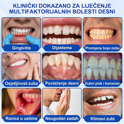 Evolvion® 🦷GumRevive gel za obnovu parodonta🍒