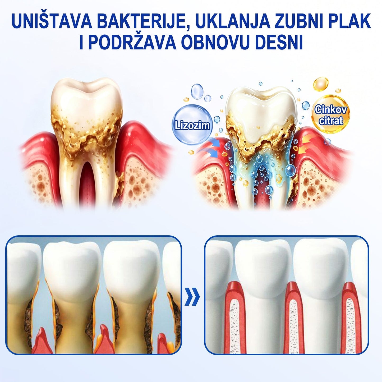 Evolvion® 🦷GumRevive gel za obnovu parodonta🍒