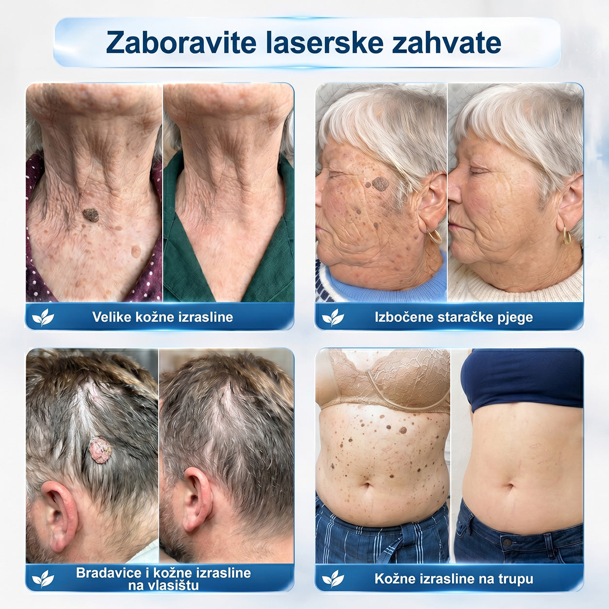 𝑱𝒆𝒅𝒊𝒏𝒂 𝒔𝒍𝒖ž𝒃𝒆𝒏𝒂 𝒕𝒓𝒈𝒐𝒗𝒊𝒏𝒂 🏆| 👩‍⚕️𝐏i𝐜𝐝o® 7 Dana Uklanjač mrlja i kožnih izraslina💗