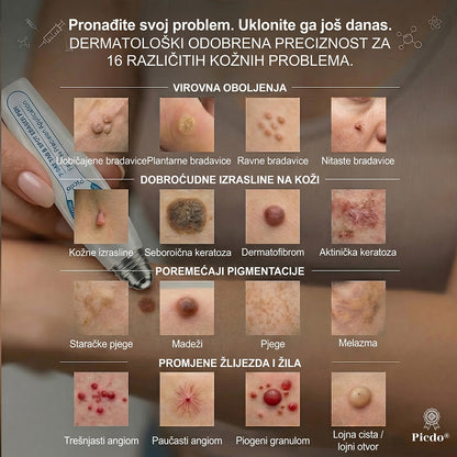 𝑱𝒆𝒅𝒊𝒏𝒂 𝒔𝒍𝒖ž𝒃𝒆𝒏𝒂 𝒕𝒓𝒈𝒐𝒗𝒊𝒏𝒂 🏆| 👩‍⚕️𝐏i𝐜𝐝o® 7 Dana Uklanjač mrlja i kožnih izraslina💗